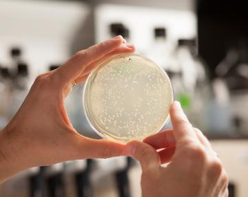 镀Petri Dish.